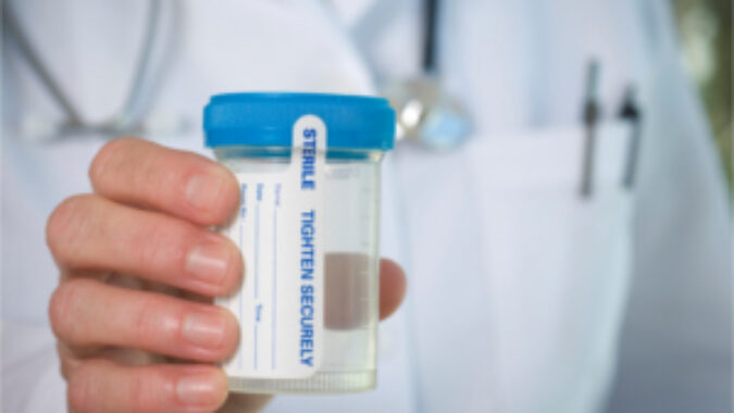 Dr. holding an emtpy urine sample container